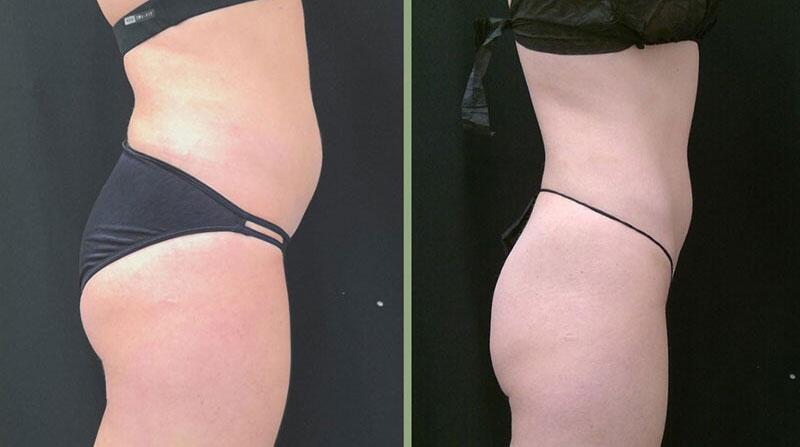 Weight Management Before & After Image